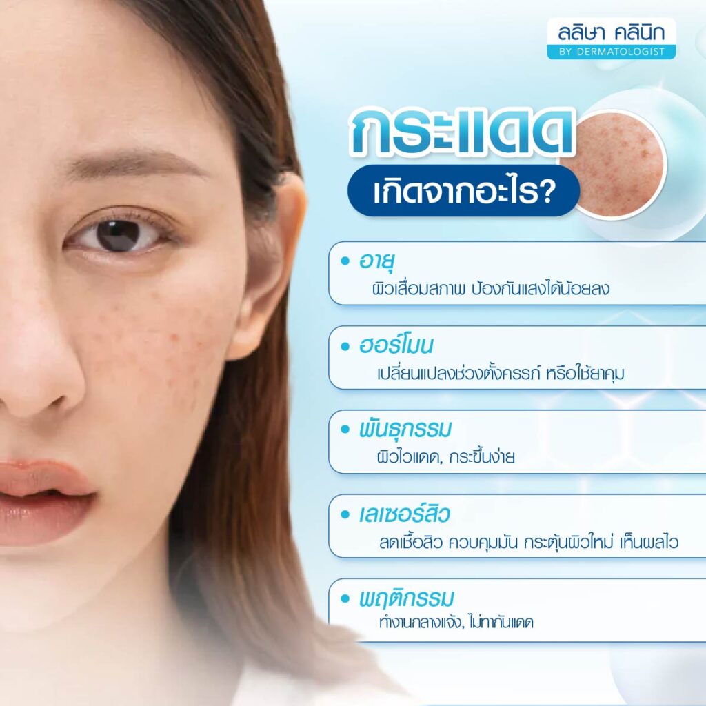สาเหตุเกิดกระแดด