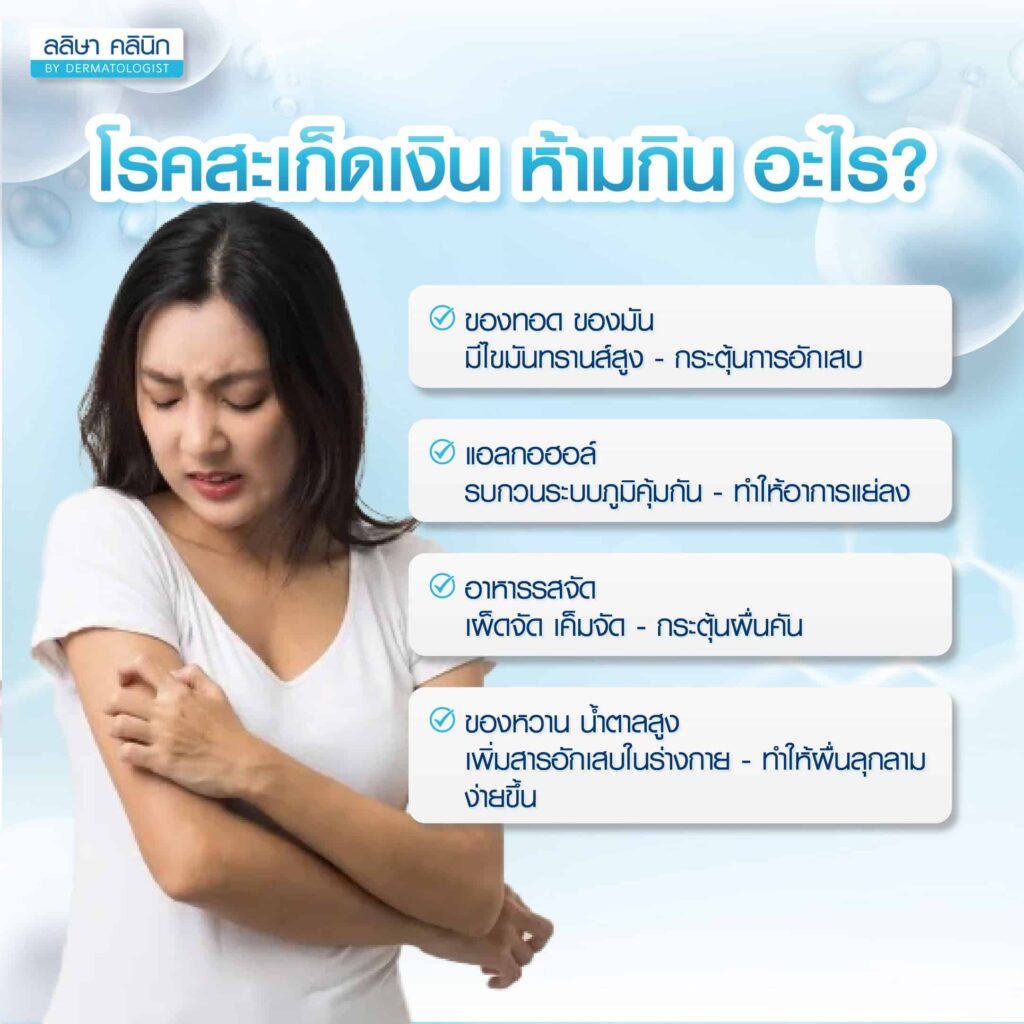 อาหารห้ามกินเมื่อเป็นโรคสะเก็ดเงิน