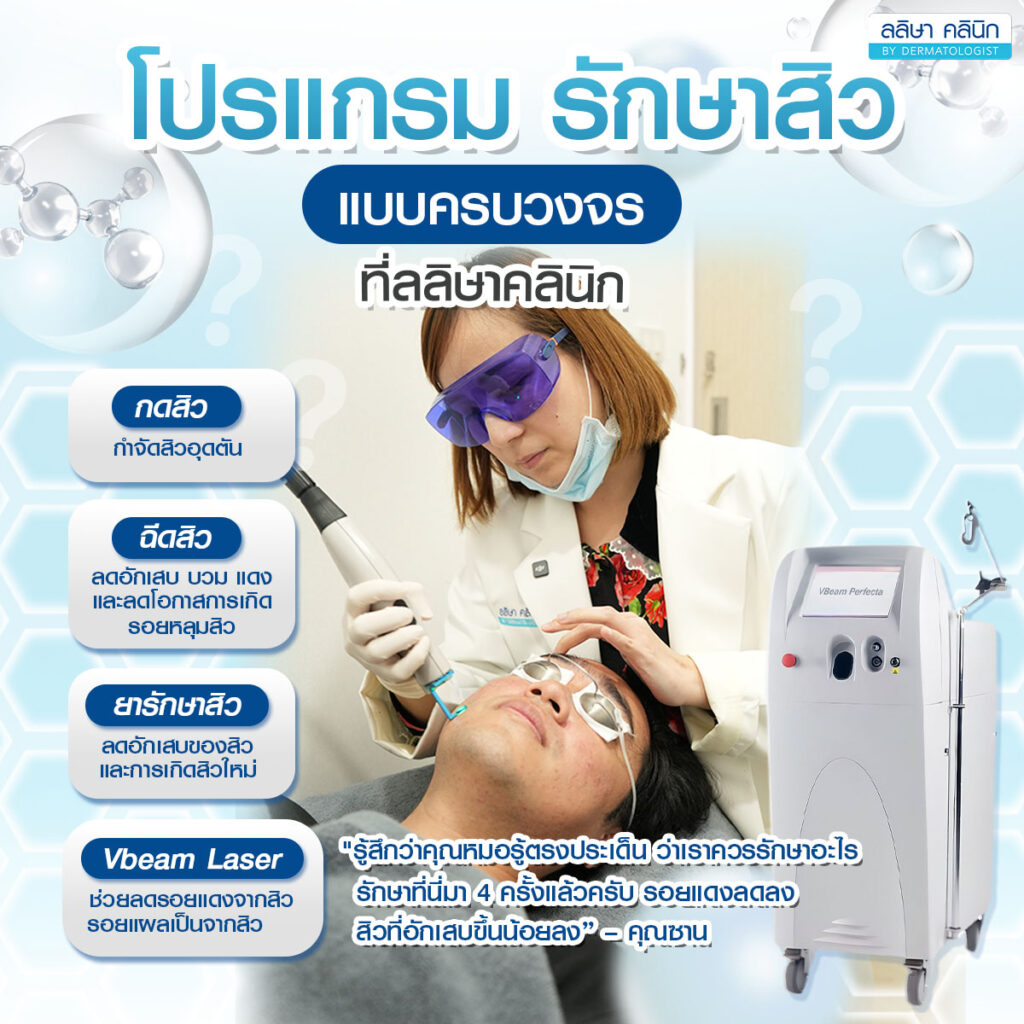 โปรแกรม รักษาสิว แบบครบวงจร ที่ลลิษา คลินิก