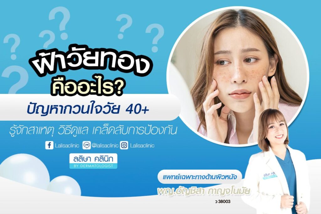 ฝ้ายวัยทอง การรักษา เคล็ดลับป้องกันฝ้าเมื่ออายุเพิ่มขึ้น