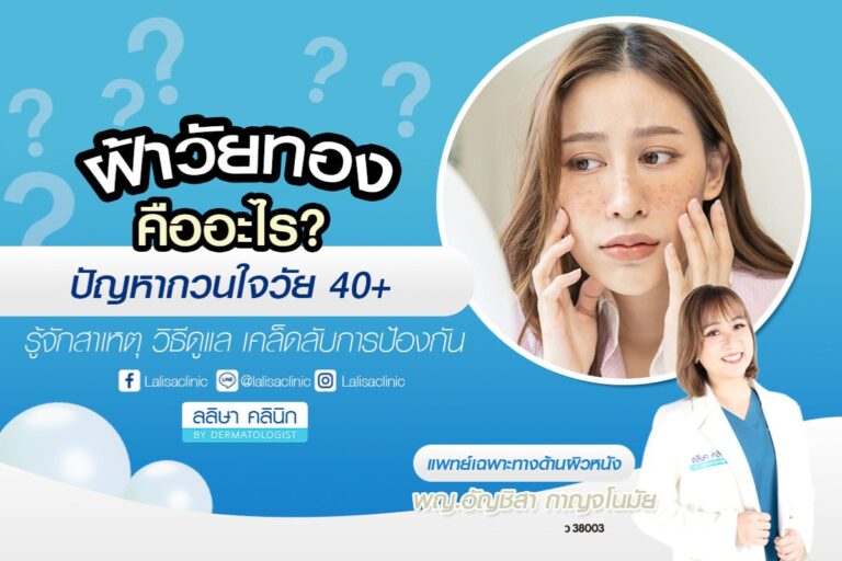ฝ้ายวัยทอง การรักษา เคล็ดลับป้องกันฝ้าเมื่ออายุเพิ่มขึ้น