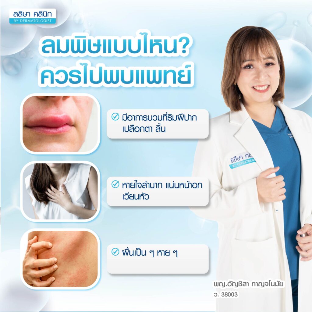 ลมพิษที่ควรไปพบแพทย์