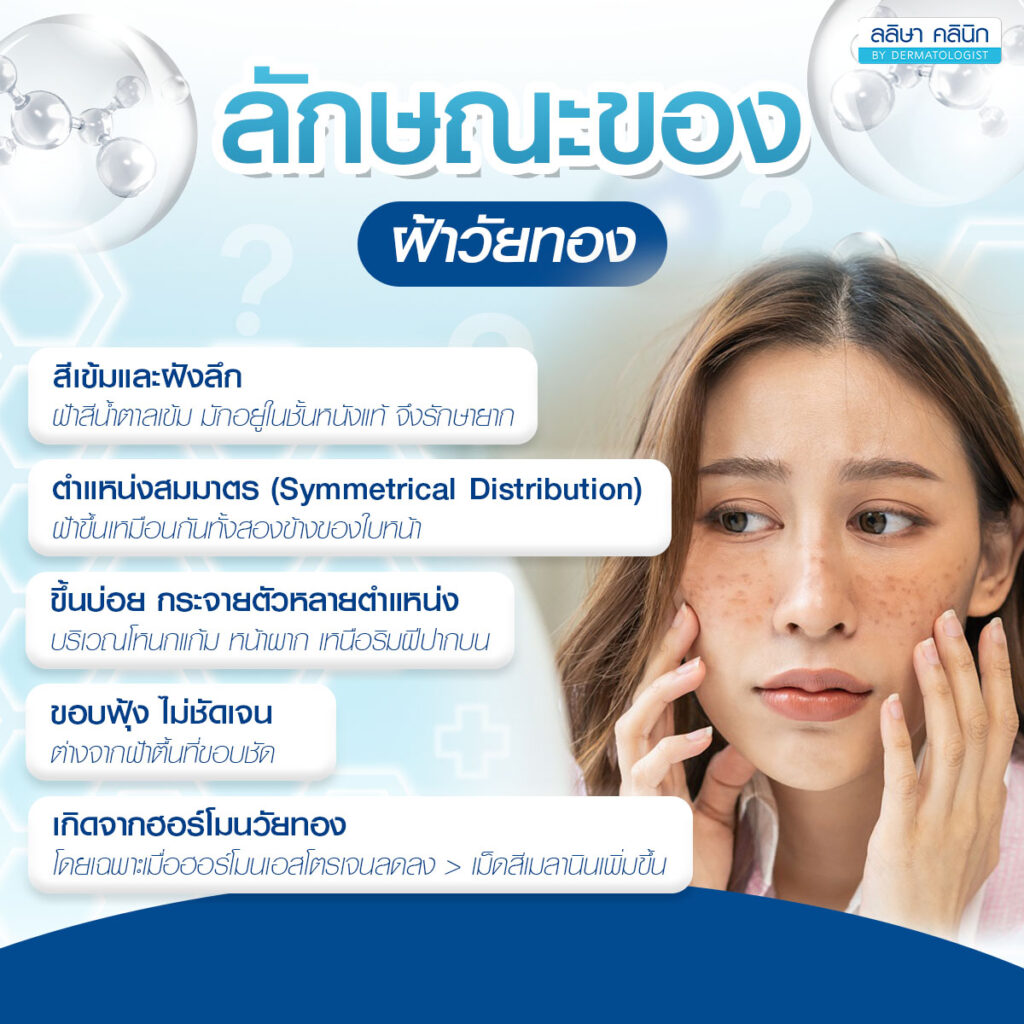 ลักษณะของฝ้าวัยทอง