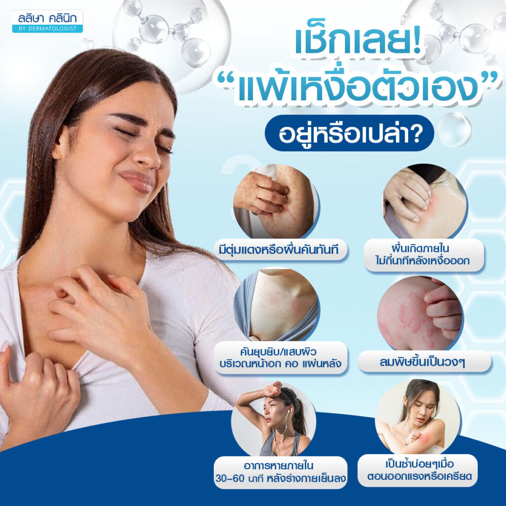 อาหาร แพ้เหงื่อตัวเอง