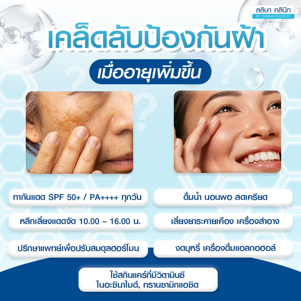 เคล็ดลับป้องกันฝ้าวัยทองเมื่ออายุเพิ่มขึ้น