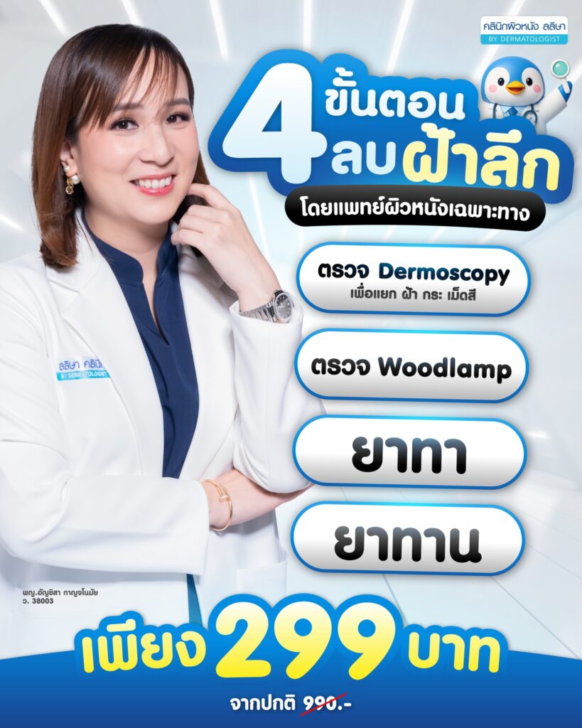 โปรโมชั่นรักษาฝ้า