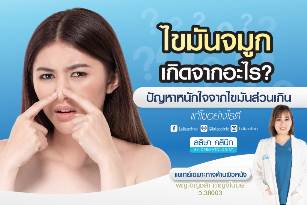 ไขมันจมูกเกิดจากอะไร ปัญหาหนักใจจากไขมันส่วนเกิน แก้ไขอย่างไร