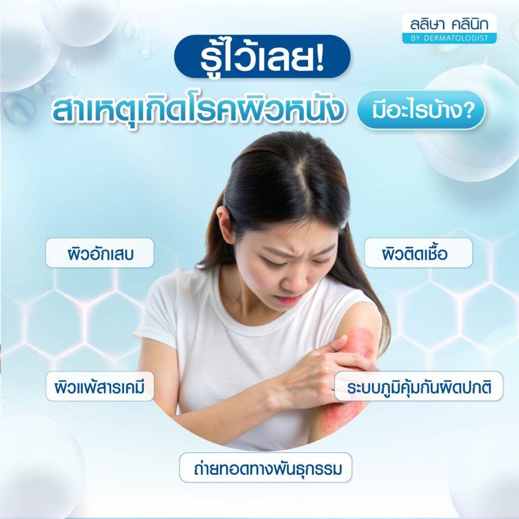 ชนิดโรคผิวหนัง