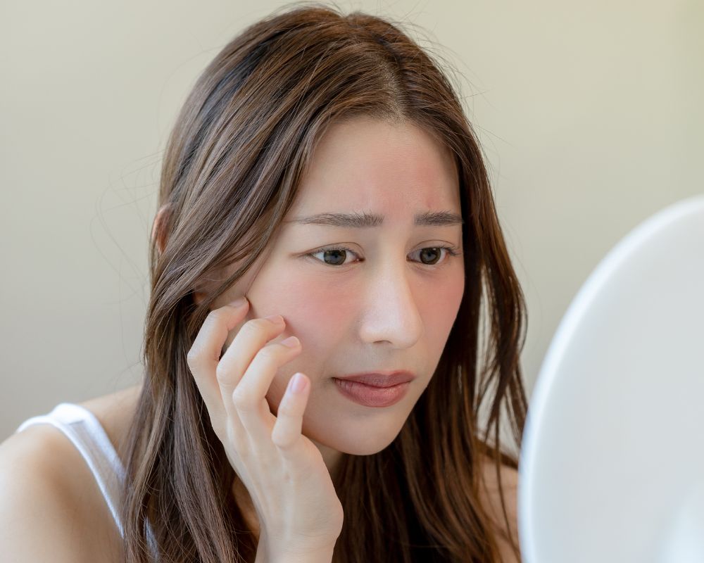 ผิวแพ้แดด