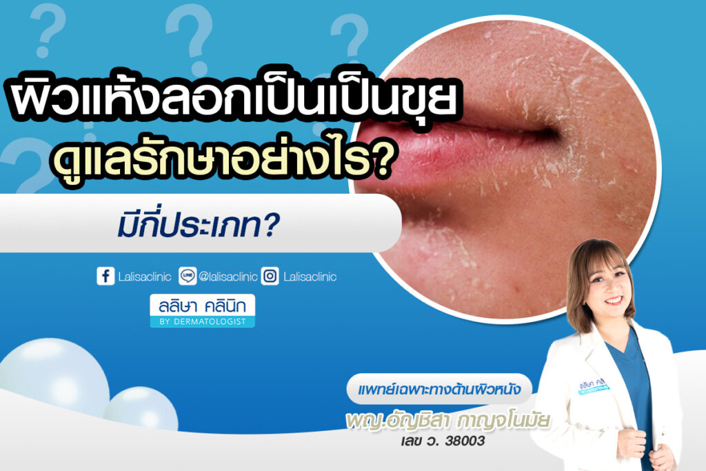ผิวแห้ง ลอกเป็นขุย ดูแลรักษาอย่างไร