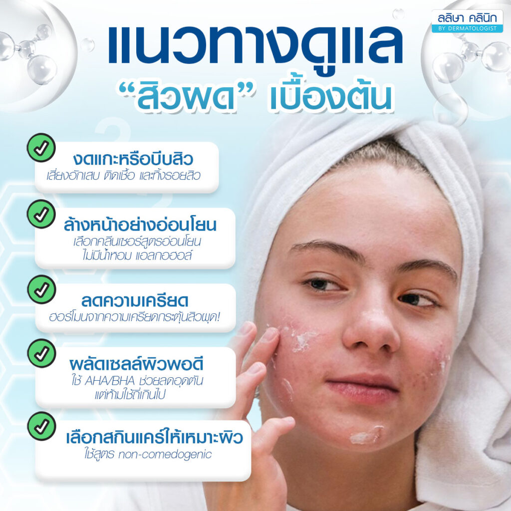 ภาพรายละเอียดการรักษาสิวผดเบื้องต้น