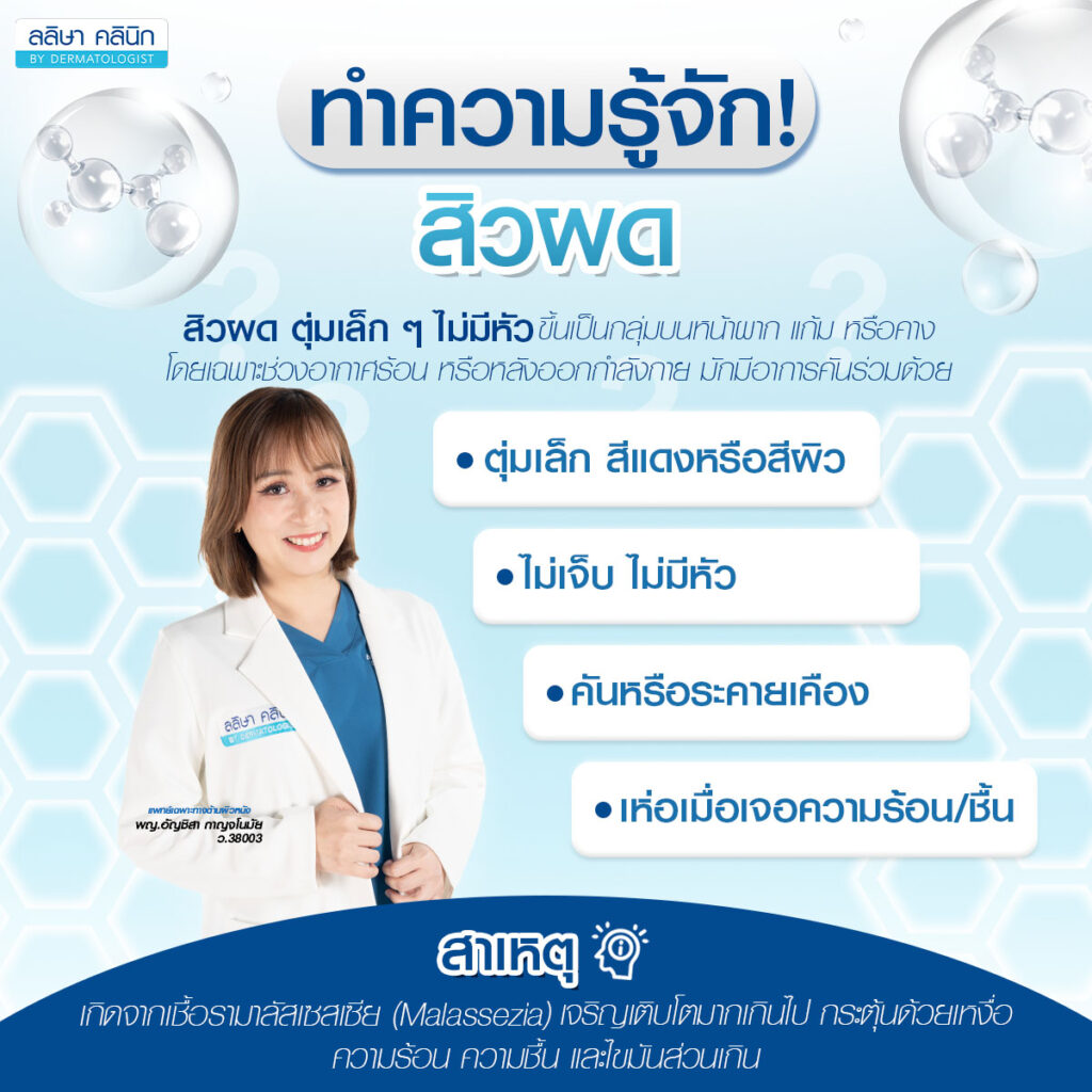 ภาพรายละเอียดสิวผด