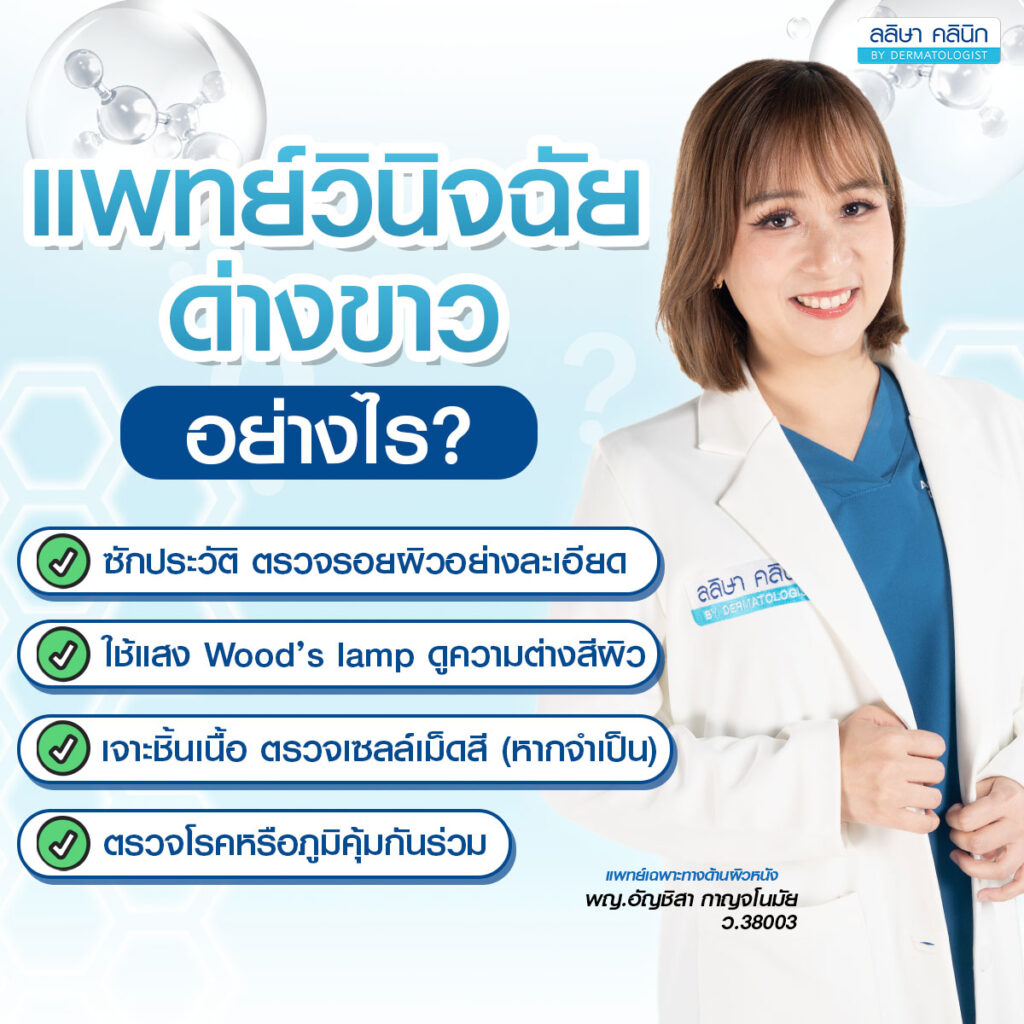 ภาพอธิบาการวินิจฉัยโรคด่างขาว จากแพทย์