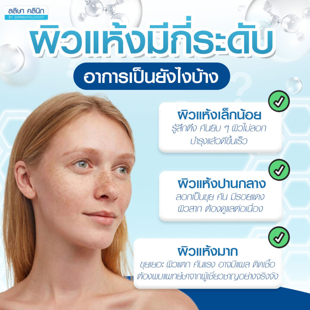 ภาพอธิบายระดับผิวแห้ง