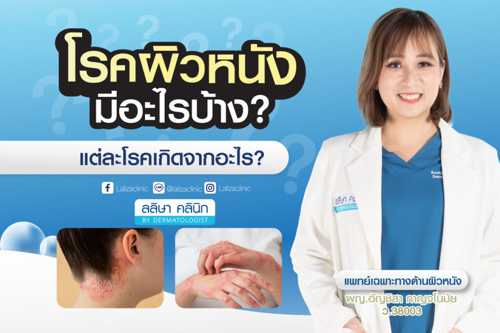 โรคผิวหนัง มีอะไรบ้าง แต่ละโรคเกิดจากอะไร