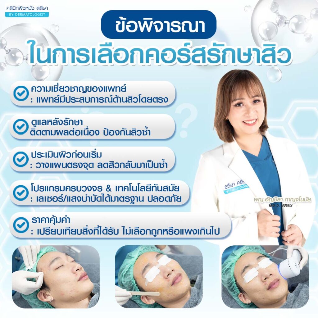 คอร์สรักษาสิวที่ไหนดี