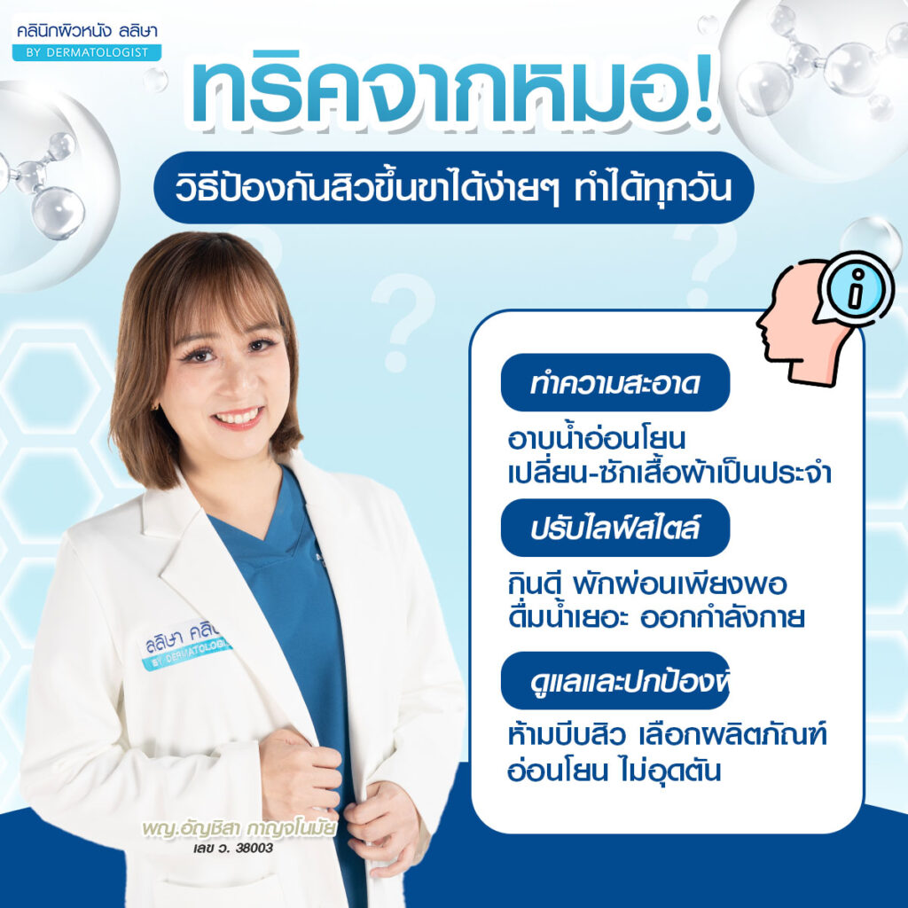 วิธีป้องกันสิวที่ขา