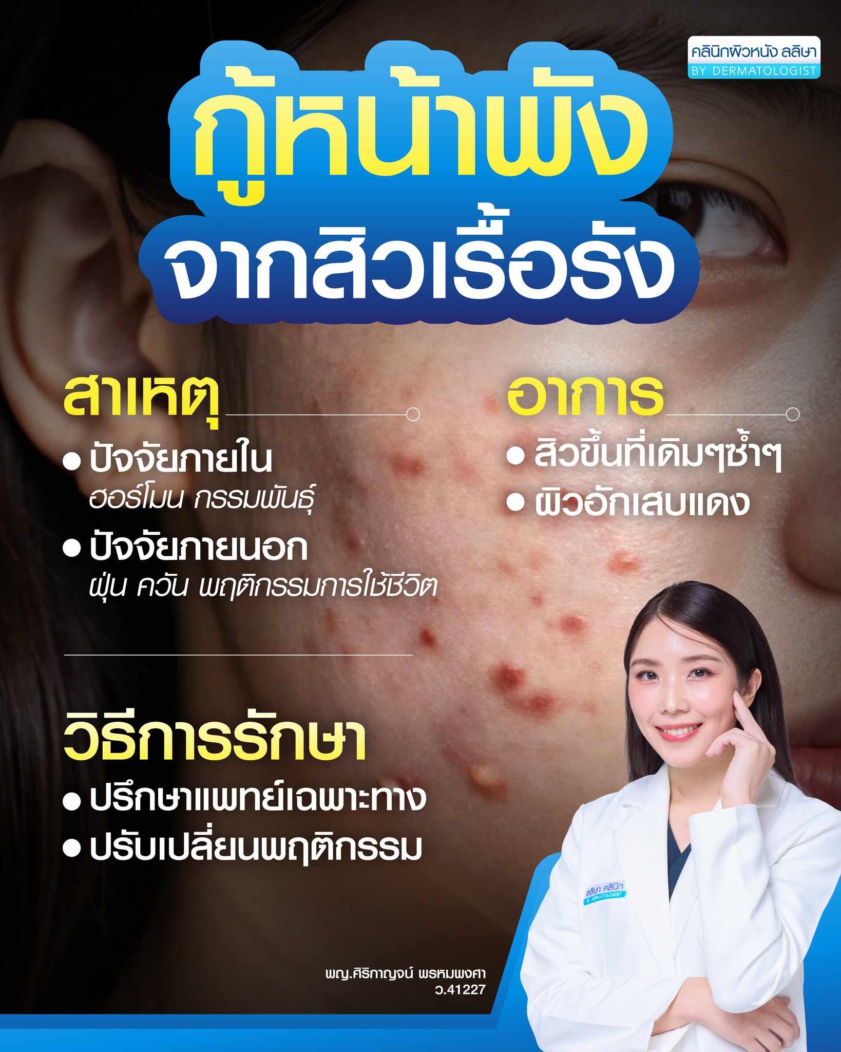 การปรึกษาแพทย์ผิวหนังเพื่อรักษาสิวเป็นแล้วไม่หาย