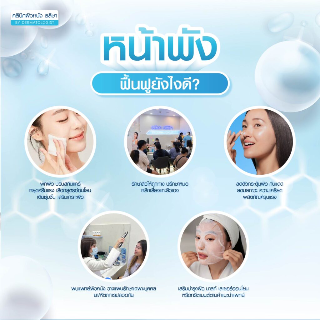 การรักษาหน้าพัง