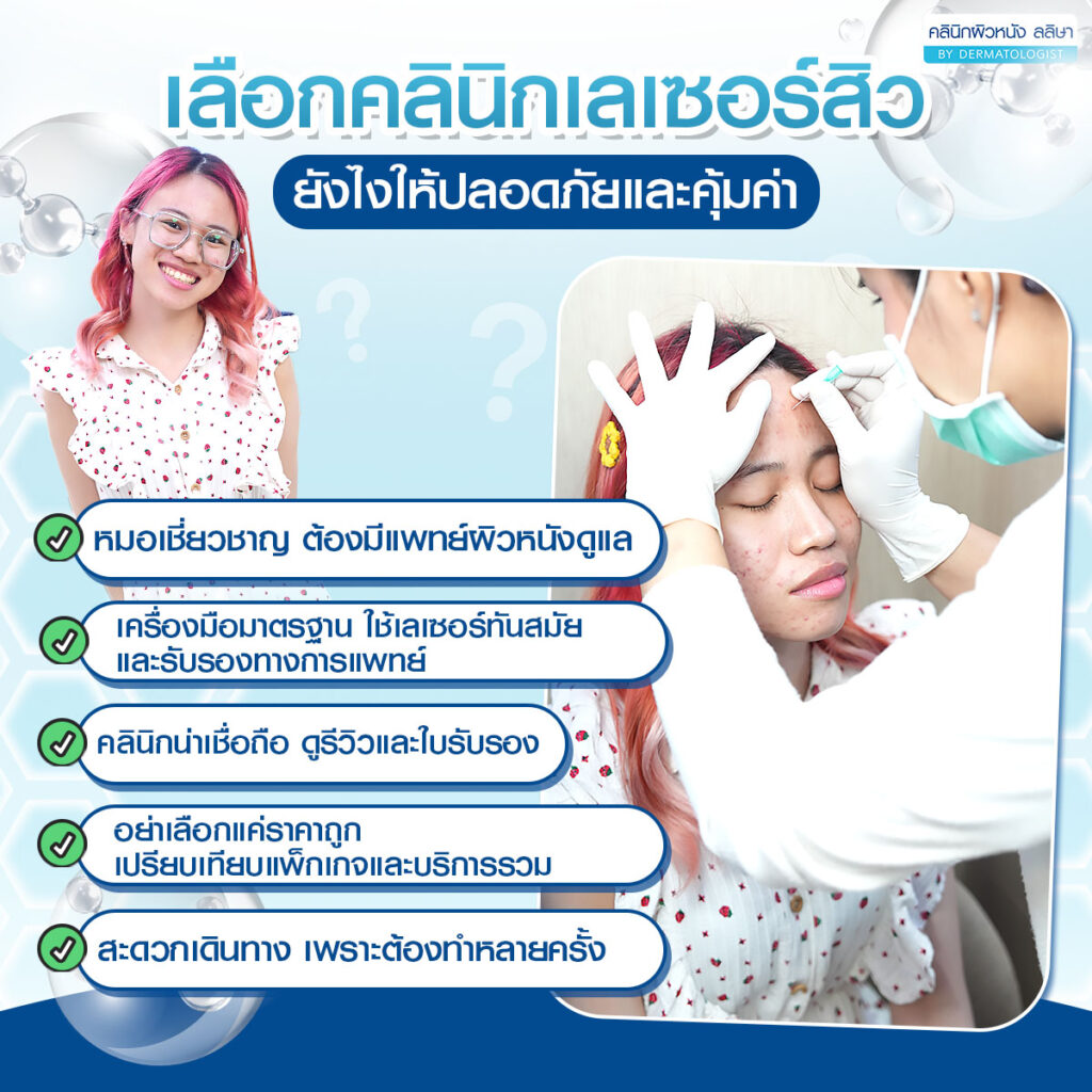 การเลือกคลินิกเลเซอร์สิว ให้ได้ราคาดีและปลอดภัย