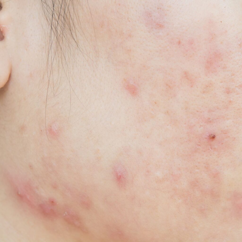 ความหมาย หน้าพัง (02)