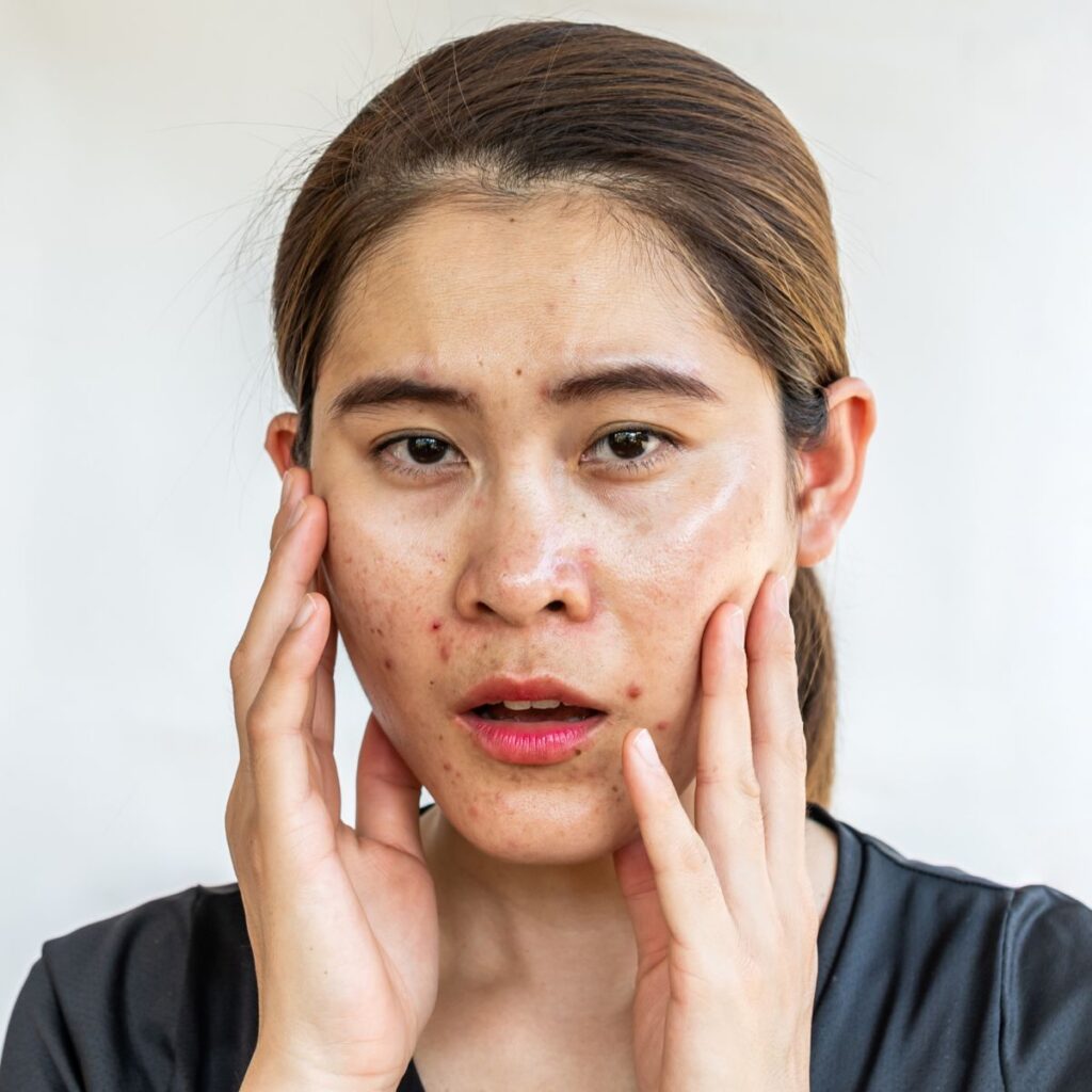 ความหมาย หน้าพัง