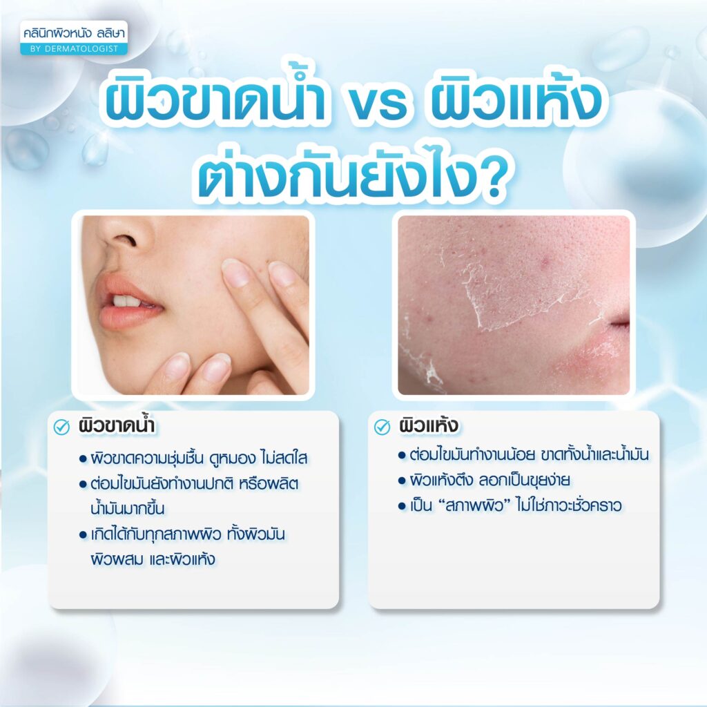 ความแตกต่างผิวขาดน้ำ ผิวแห้ง