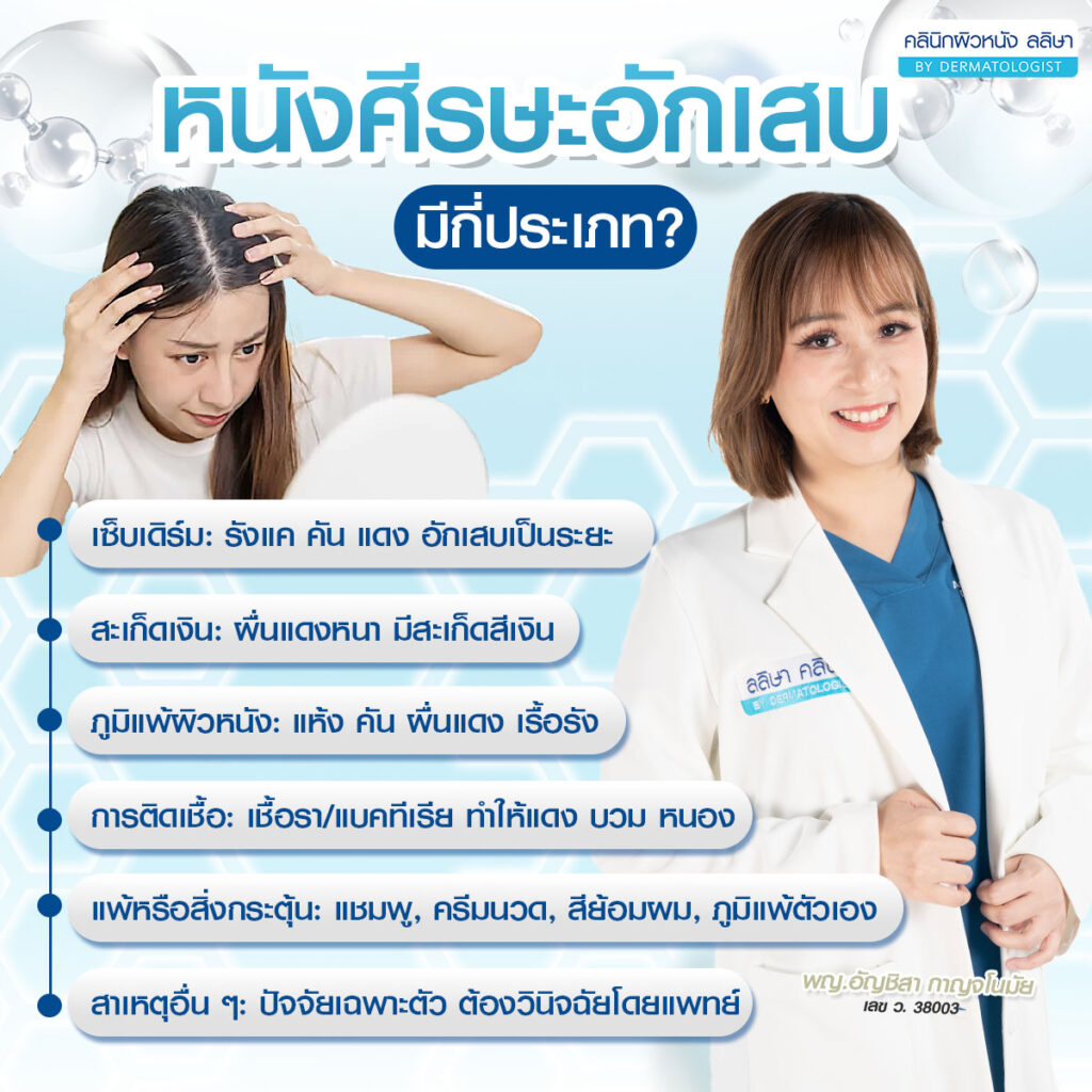 ประเภท หนังศีรษะอักเสบ