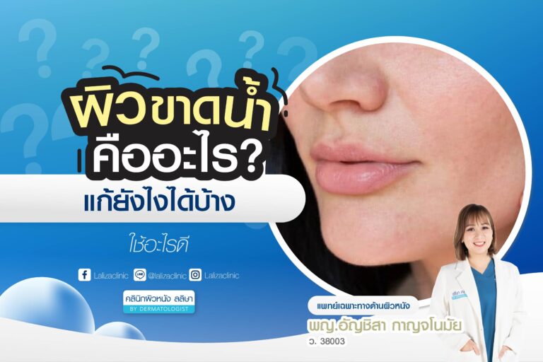 ผิวขาดน้ำ คืออะไร? แก้ยังไงดี