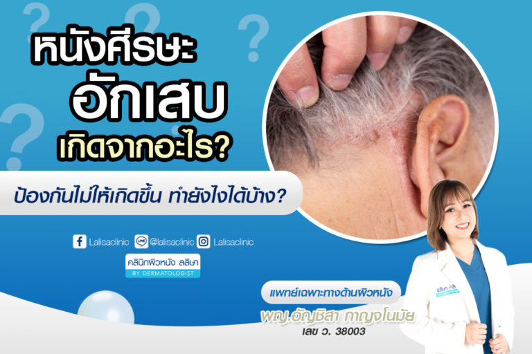 รวมวิธีรักษาหนังศีรษะอักเสบ ให้ผิวกลับมาแข็งแรง