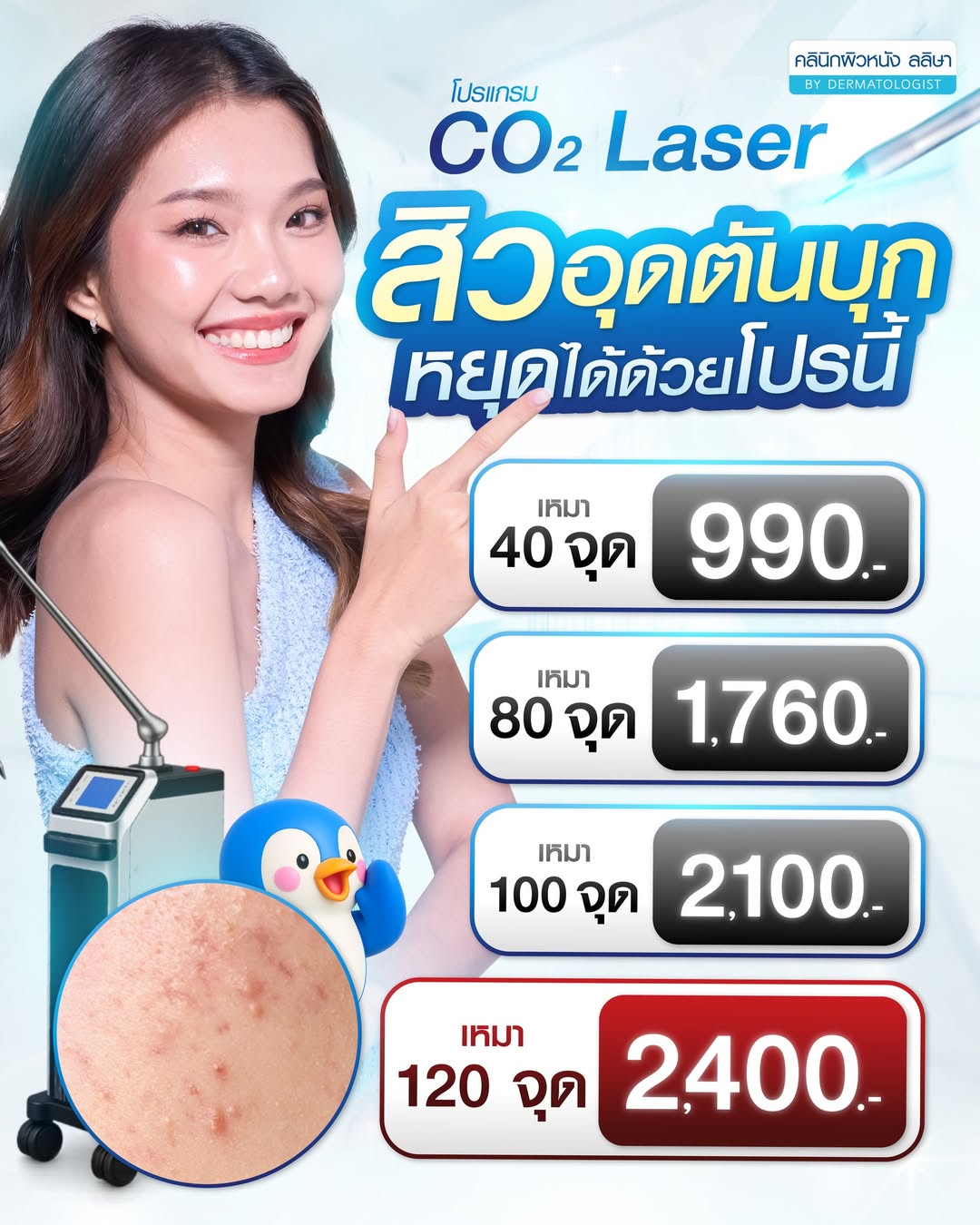 ราคา เลเซอร์สิว