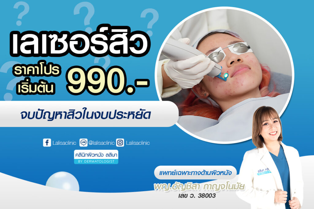 เลเซอร์สิว ราคา เริ่มต้น 990.- จบปัญหาสิวราคาคุ้มค่า