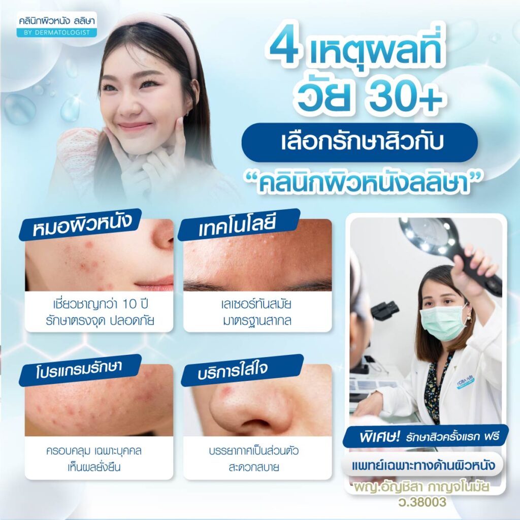 เหตุผลที่วัยผู้ใหญ่เลือกรักษาสิววัยผู้ใหญ่ที่คลินิกผิวหนังลลิษา