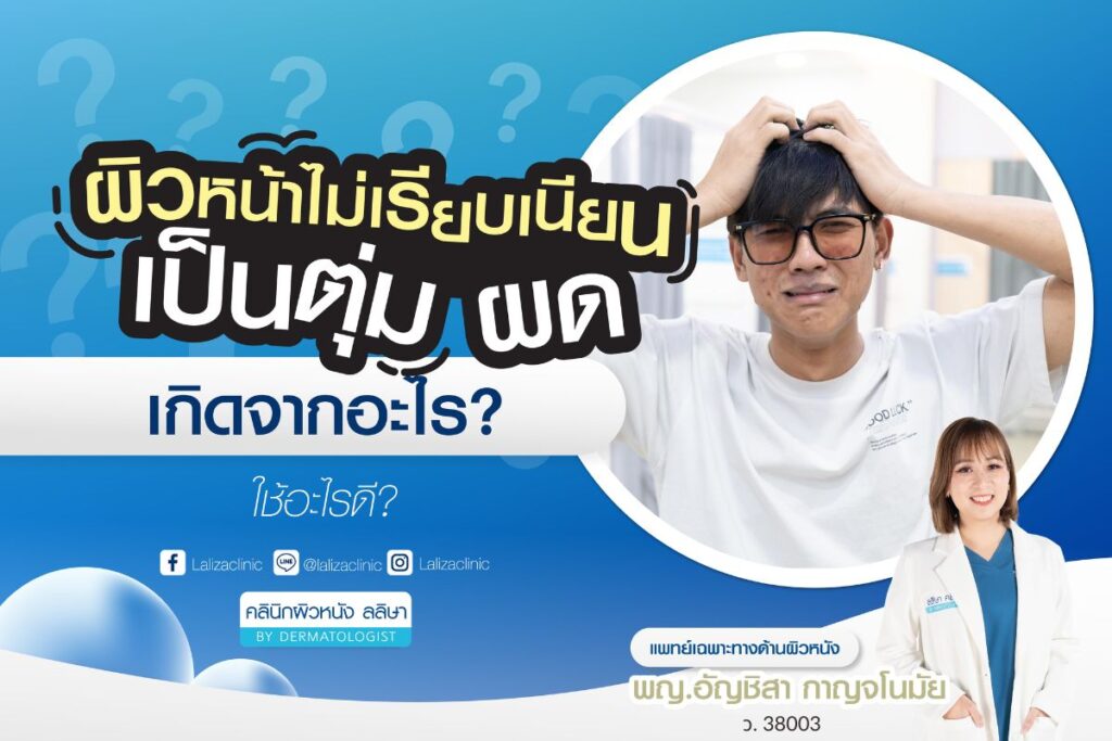 5 สาเหตุผิวหน้าไม่เรียบเนียน