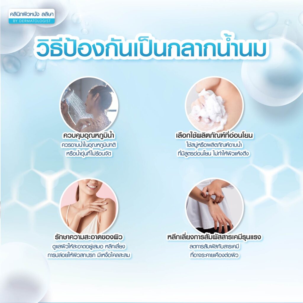 การป้องกัน