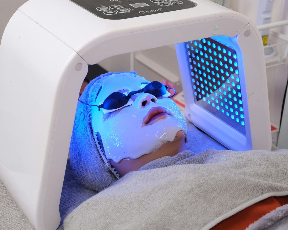 ฉายแสงรักษาสิว (02)