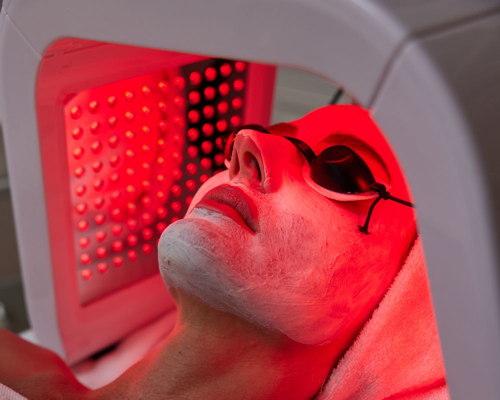 ฉายแสงรักษาสิว