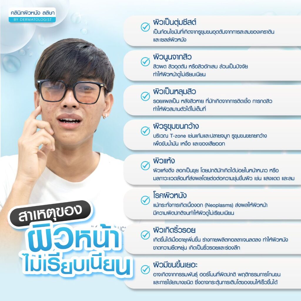 ผิวหน้าไม่เรียบเนียน มีกี่แบบ