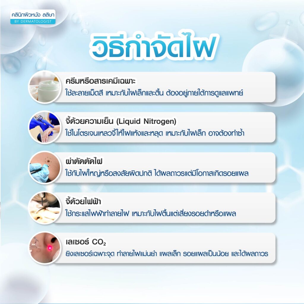 รวมวิธีกำจัดไฝ