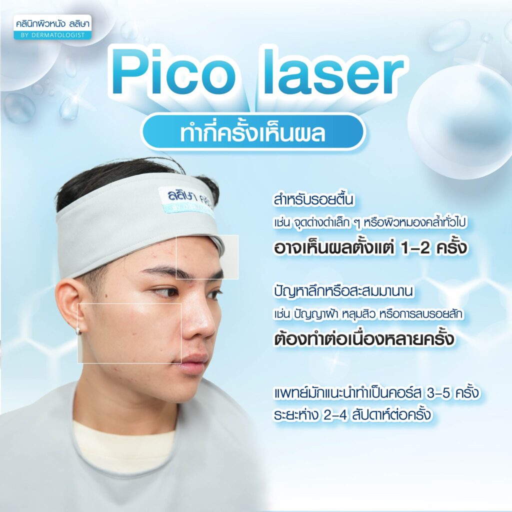 ระยะเห็นผลหลังทำPico Laser