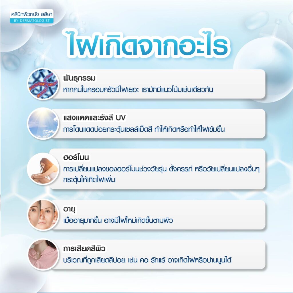 สาเหตุการเกิดไฝ