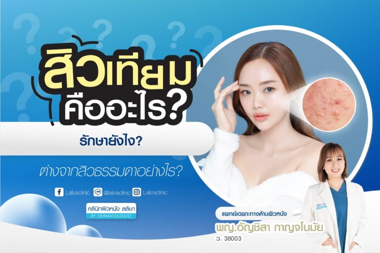 สิวเทียม ลักษณะ การรักษา ความแตกต่างจากสิวทั่วไป