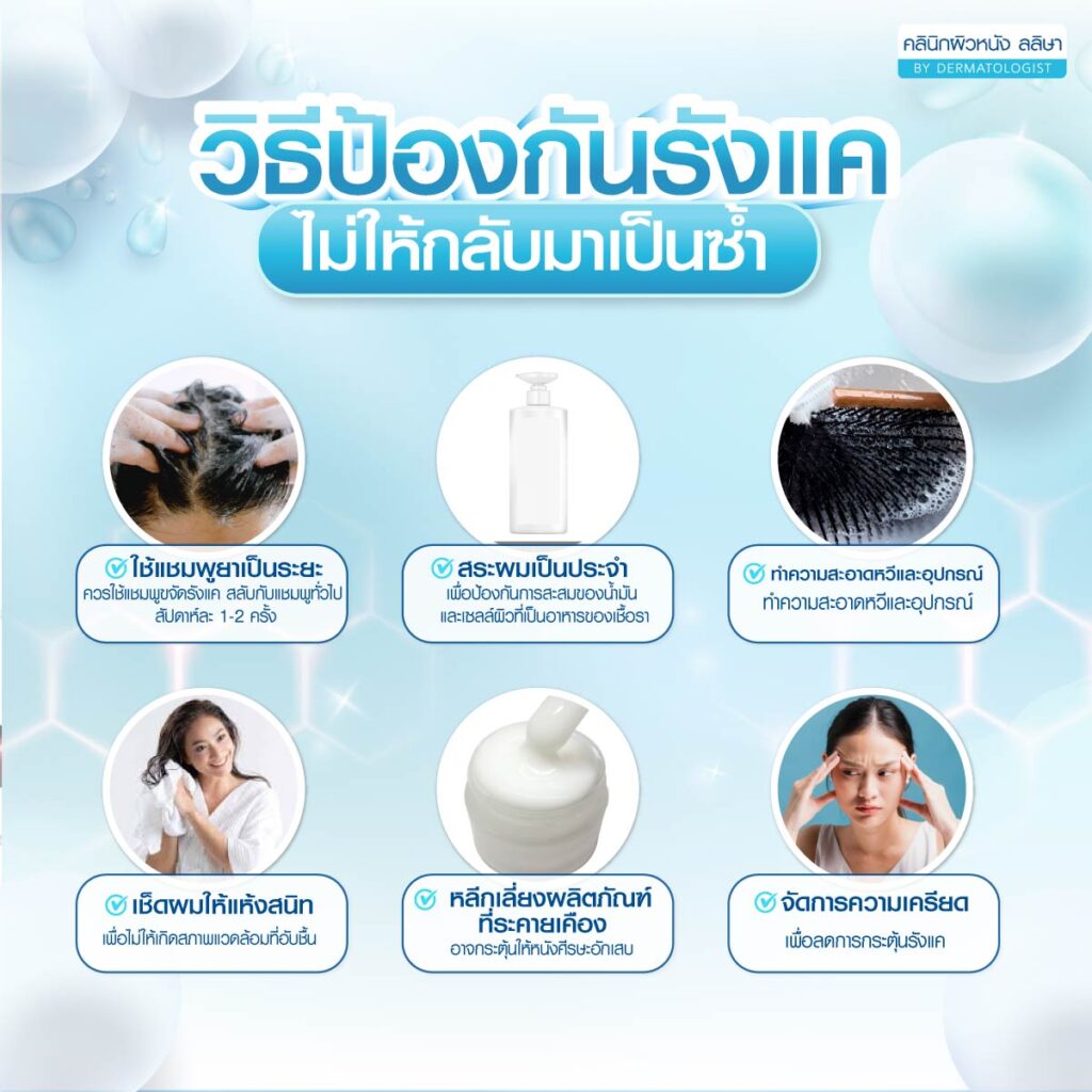 6 วิธีป้องกันรังแค