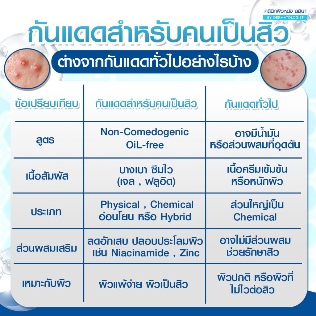 กันแดดสำหรับคนเป็นสิวต่างจากกันแดดทั่วไปอย่างไรบ้าง