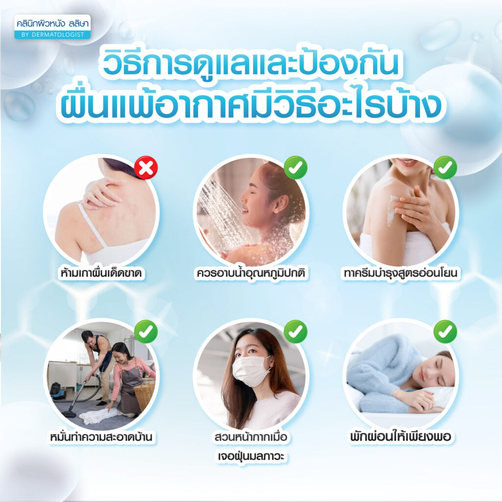 การดูแลป้องกันไม่ให้เป็นผื่นแพ้อากาศ