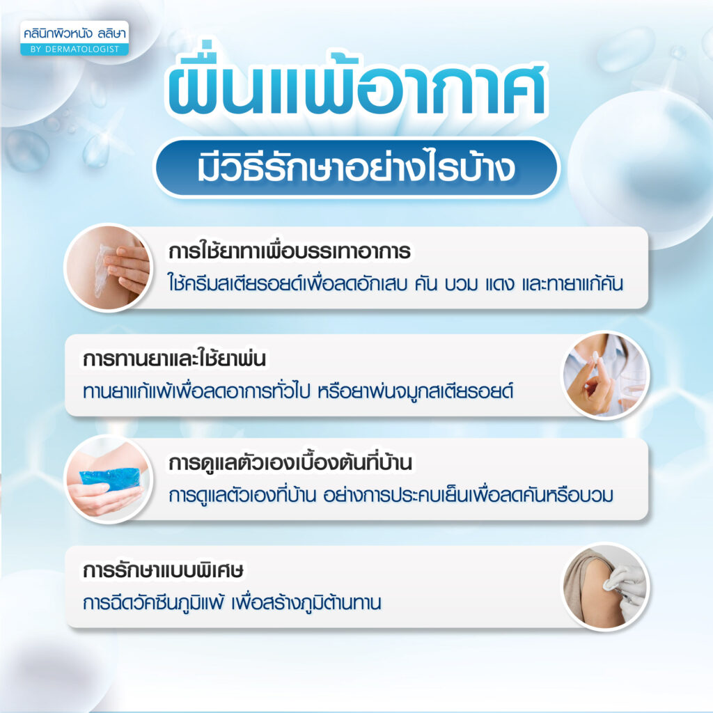การรักษา ผื่นแพ้อากาศ