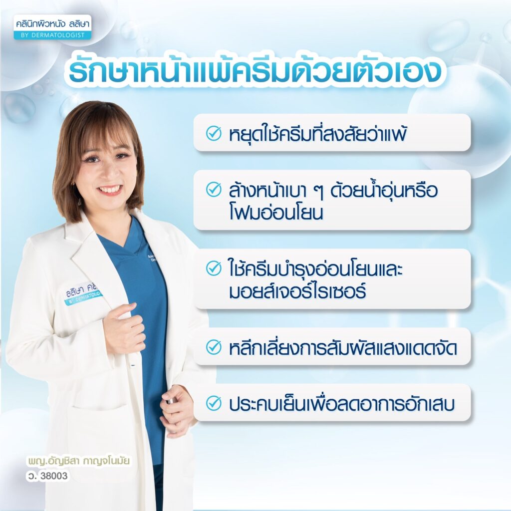 การรักษาหน้าแพ้ครีม ด้วยตัวเอง