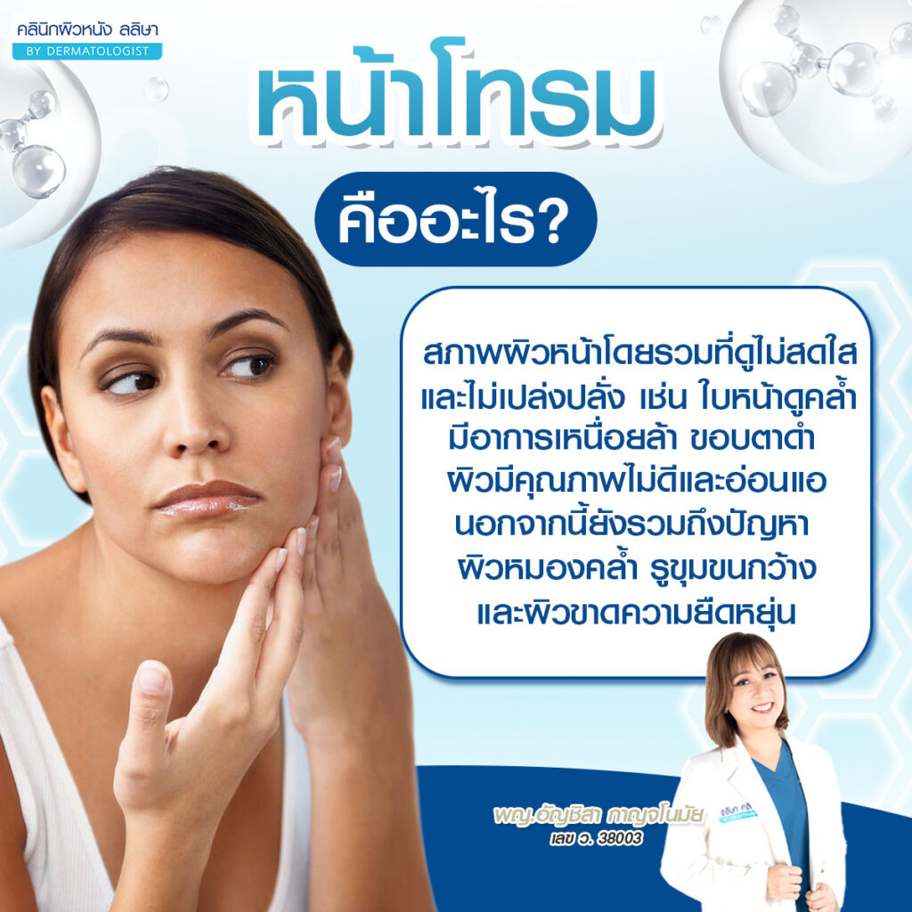 ความหมาย หน้าโทรม