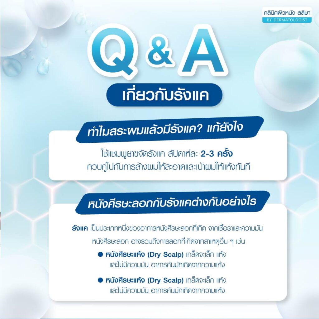 คำถามพบบ่อยเกี่ยวกับรังแค