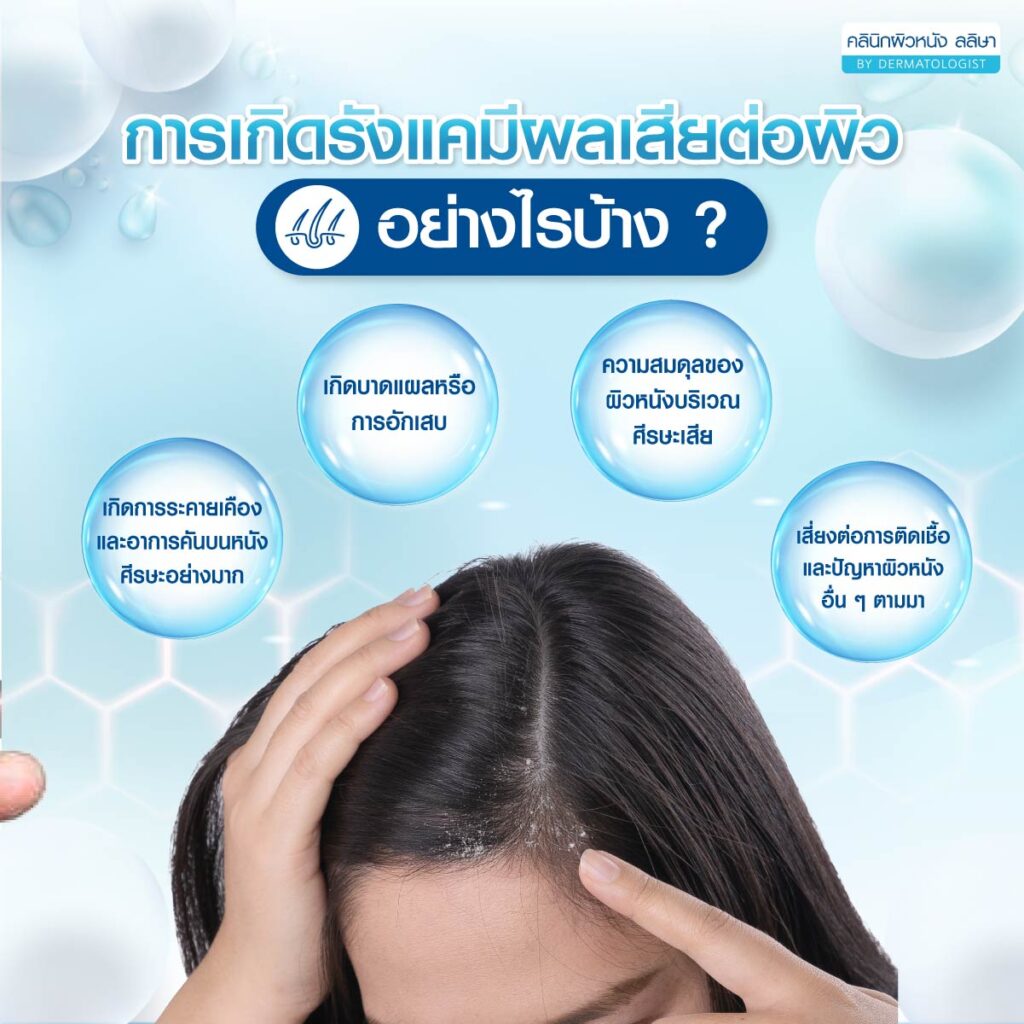 ผลเสียการเกิดรังแค